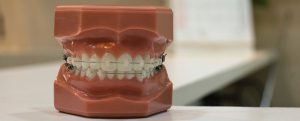 Comparar tratamientos de ortodoncia