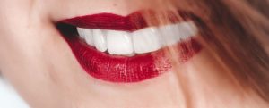mitos sobre el blanqueamiento dental