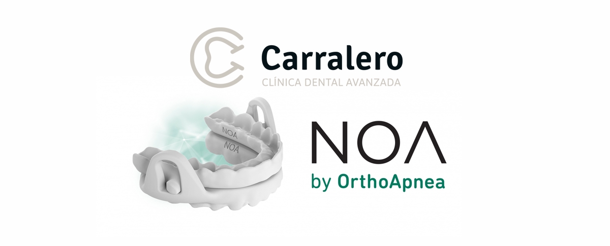 OrthoApnea aparato antironquidos - Dental Siglo XXI