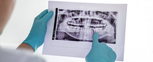 osteoporosis y salud dental