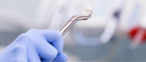 que comer despues de extraer una muela