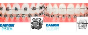 Sistema Damon
